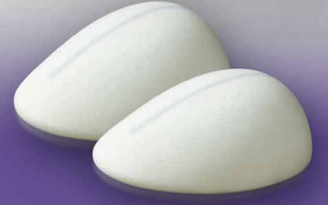 Les prothèses mammaires en polyuréthane : de nouveaux implants mammaires ?